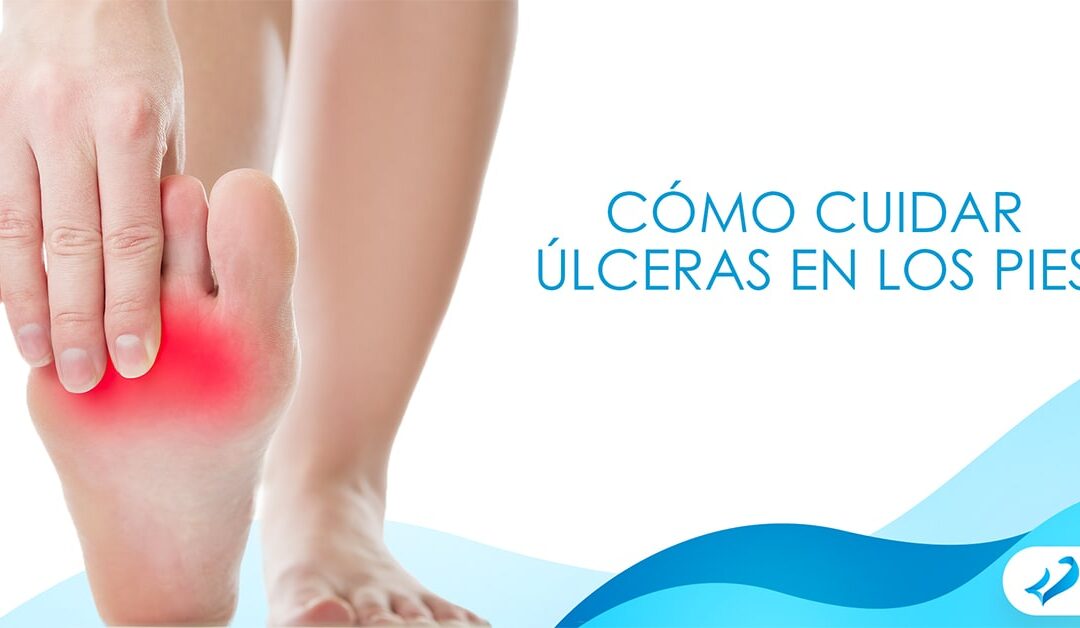 Cómo cuidar úlceras en los pies por diabetes