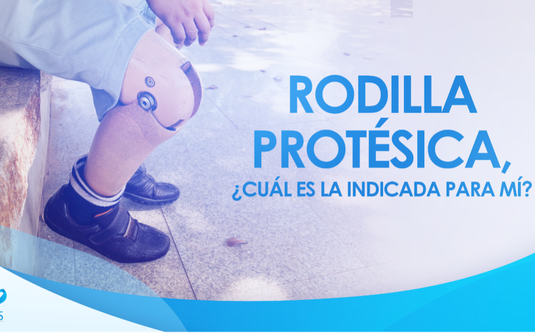 Rodilla protésica, ¿cuál es la indicada para mí?