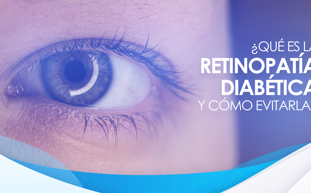 ¿Qué es la retinopatía diabética y cómo evitarla?