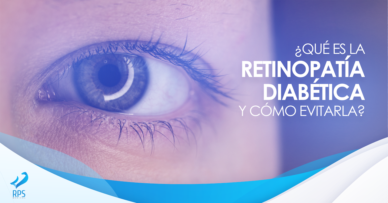 ¿Qué es la retinopatía diabética y cómo evitarla?