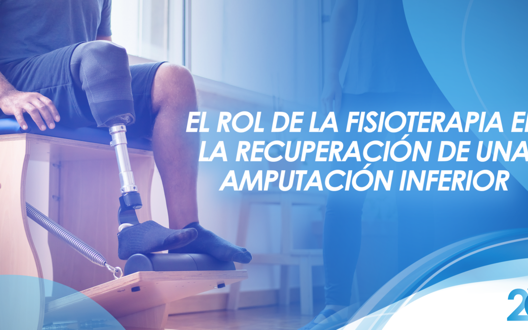 El rol de la fisioterapia en la recuperación de una amputación inferior